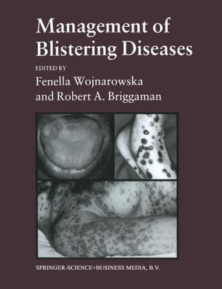 Management of Blistering Diseases -  Robert A. Briggaman Fenella Wojnarowska