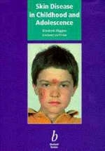 Skin Disease in Childhood and Adolescence - Elisabeth Higgins, Dr Anthony DuVivier