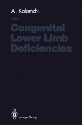 Congenital Lower Limb Deficiencies - 