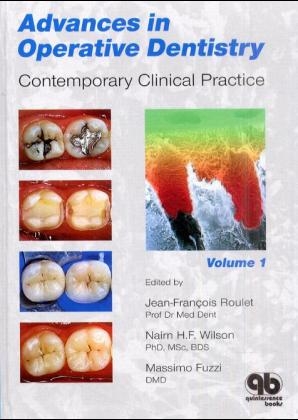 Advances in Operative Dentistry - 