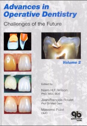 Advances in Operative Dentistry - 