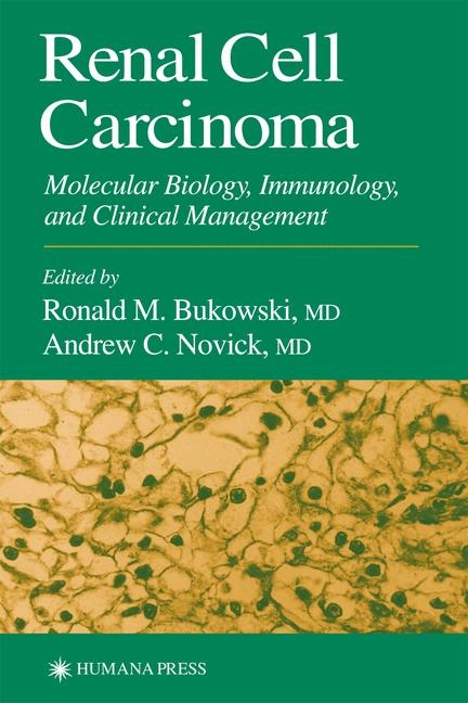 Renal Cell Carcinoma - 