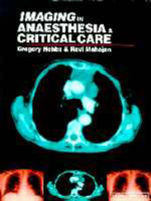 Imaging in Anaesthesia and Critical Care - Gregory J. Hobbs, Ravi P. Mahajan