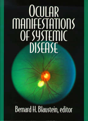 Ocular Manifestations of Systemic Disease - 