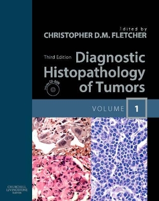 Diagnostic Histopathology of Tumors - 