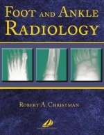 Foot and Ankle Radiology - Robert A. Christman