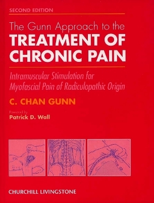 The Gunn Approach to the Treatment of Chronic Pain - C. Chan Gunn