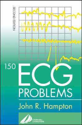 150 ECG Problems - John R. Hampton