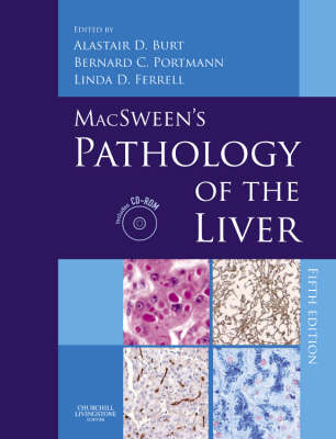 MacSween's Pathology of the Liver - 