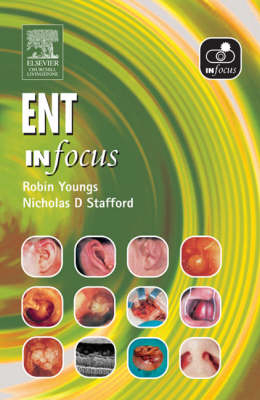 ENT in Focus - Robin Youngs, Nicholas D. Stafford