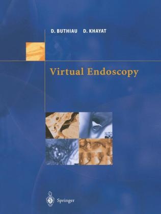 Virtual Endoscopy -  Didier Buthiau,  David Khayat