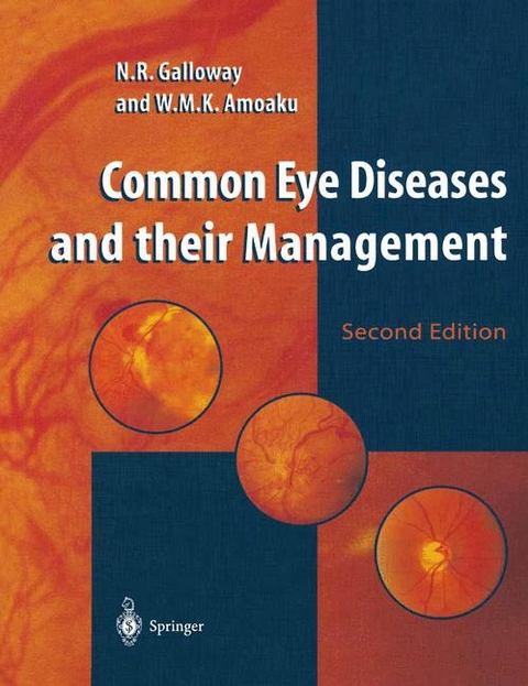 Common Eye Diseases and their Management -  Winfried Mawutor Kwaku Amoaku,  Nicholas Robert Galloway