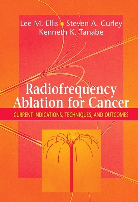 Radiofrequency Ablation for Cancer - 