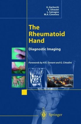 Rheumatoid Hand -  M.A. Cimmino,  G. Garlaschi,  L. Satragno,  E. Silvestri