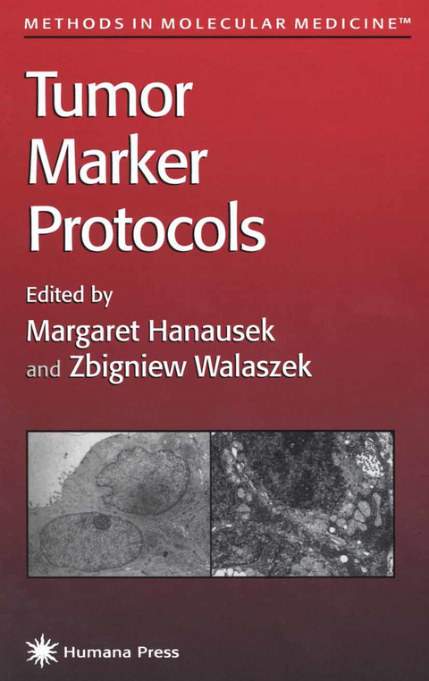 Tumor Marker Protocols - 