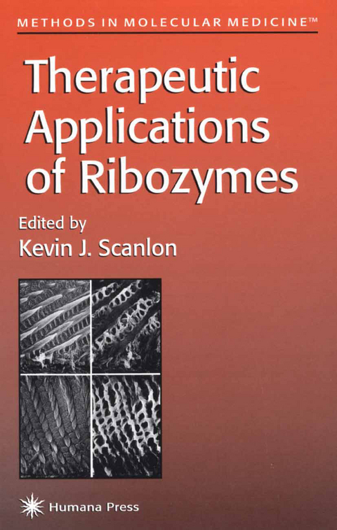 Therapeutic Applications of Ribozymes - 