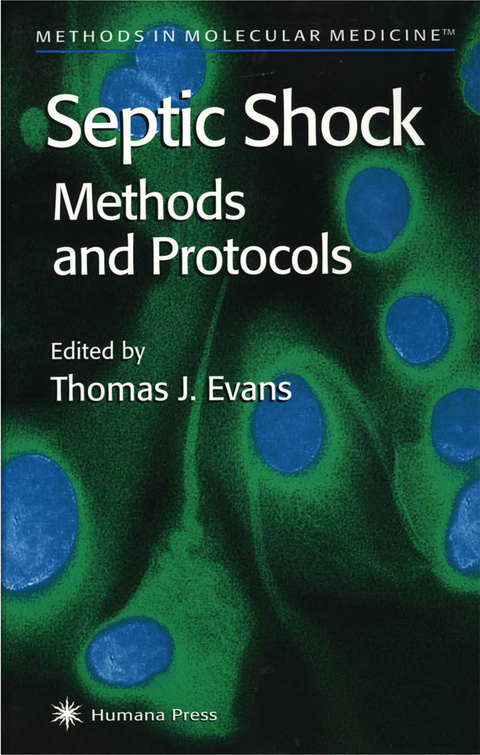 Septic Shock Methods and Protocols - 