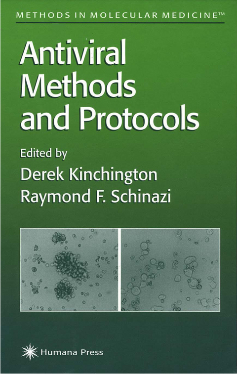 Antiviral Methods and Protocols - 