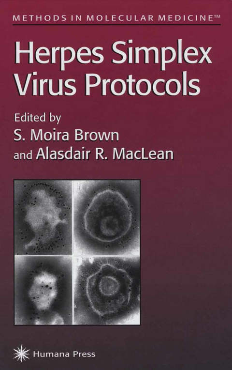 Herpes Simplex Virus Protocols - 