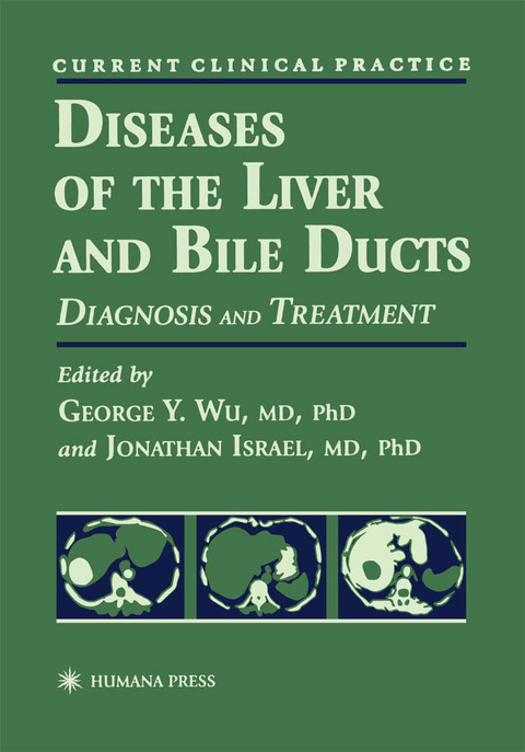 Diseases of the Liver and Bile Ducts - 