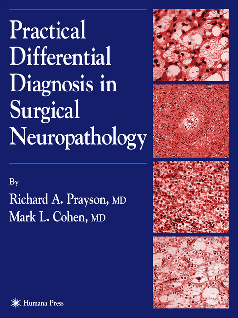 Practical Differential Diagnosis in Surgical Neuropathology - Richard A. Prayson, Mark L. Cohen