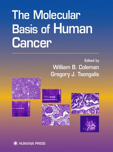 The Molecular Basis of Human Cancer - 