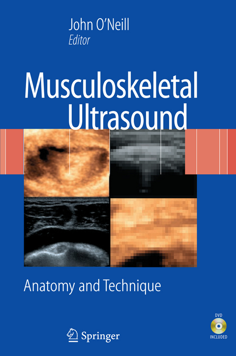 Musculoskeletal Ultrasound - 