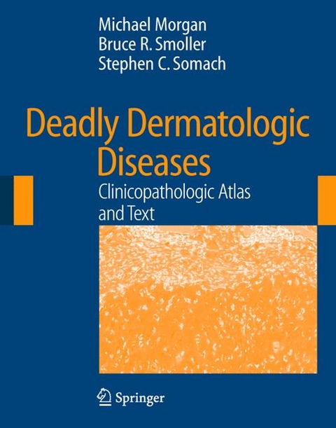 Deadly Dermatologic Diseases - Michael B. Morgan, Bruce Smoller, Stephen Somach