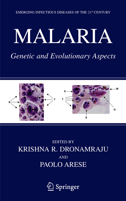 Malaria - 