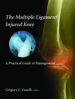 The Multiple Ligament Injured Knee - G.C. Fanelli