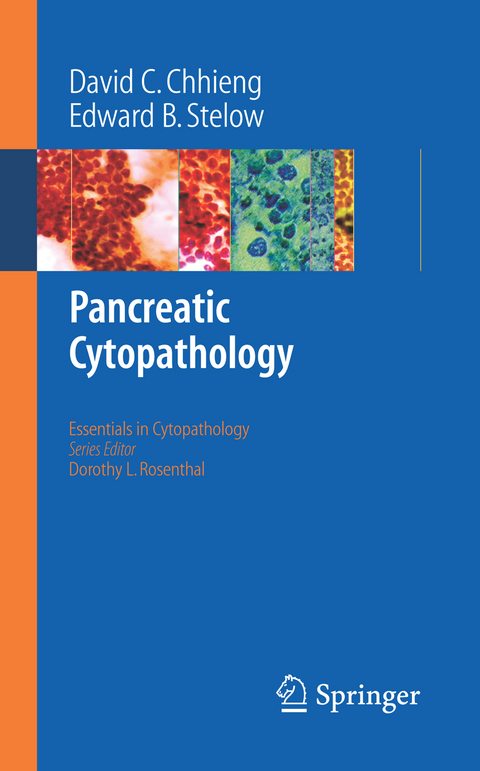 Pancreatic Cytopathology - David C. Chhieng, Edward B. Stelow