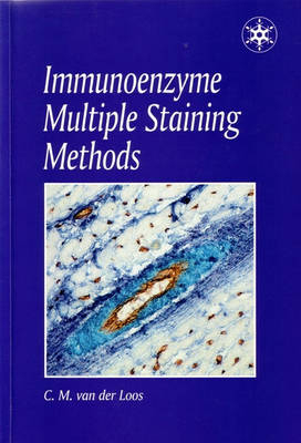 Immunoenzyme Multiple Staining