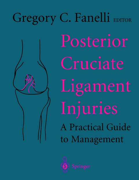 Posterior Cruciate Ligament Injuries - 