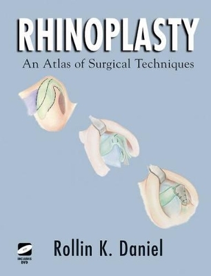 Rhinoplasty - Rollin K. Daniel