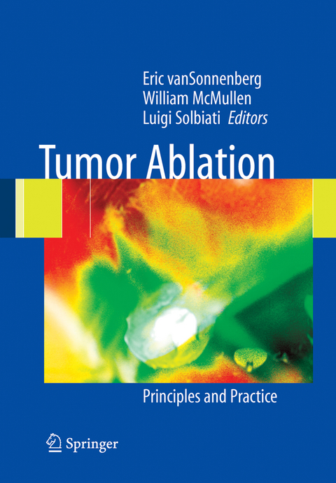 Tumor Ablation - 