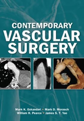 Contemporary Vascular Surgery - James Yao, William Pearce