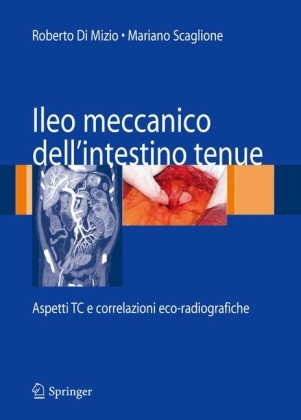 Ileo Meccanico Dell'intestino Tenue - 