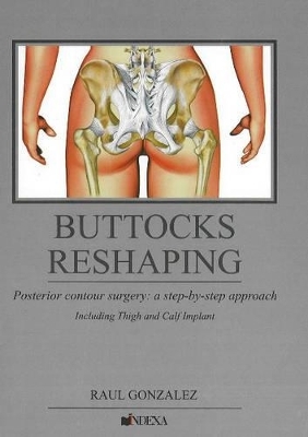 Buttocks Reshaping - Raul Gonzalez