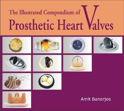 The Illustrated Compendium of Prosthetic Heart Valves - Amit Banerjee