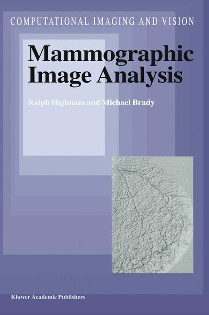 Mammographic Image Analysis -  J.M. Brady,  R. Highnam