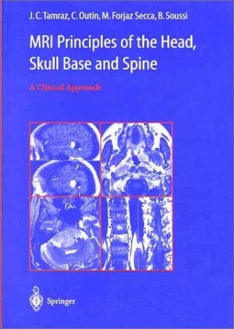 MRI Principles of the Head, Skull Base and Spine -  C. Outin,  M. Forjaz Secca,  B. Soussi,  J.C. Tamraz