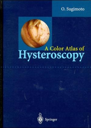 Color Atlas of Hysteroscopy -  Osamu Sugimoto