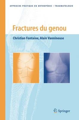 Fractures Du Genou - Christian Fontaine, Alain Vannineuse