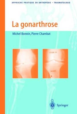 La Gonarthrose - M Bonnin, P Chambat, Michel Bonnin, Pierre Chambat