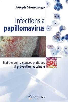 Infections a Papillomavirus - Joseph Monsonego