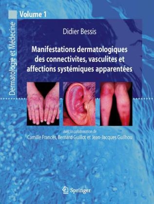 Manifestations Dermatologiques DES Connectivites Vasculites ET Affections Systemiques Apparentees - Didier Bessis