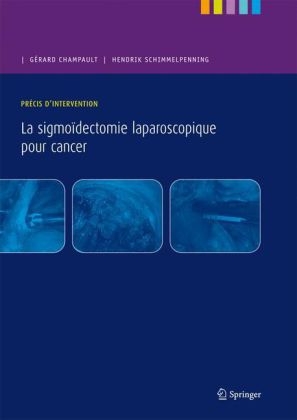 Précis d'Intervention. La Sigmoïdectomie Laparoscopique Pour Cancer - Gerard Champault, Hendrik Schimmelpenning