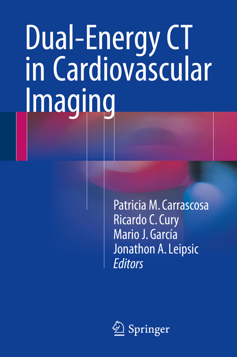 Dual-Energy CT in Cardiovascular Imaging - 