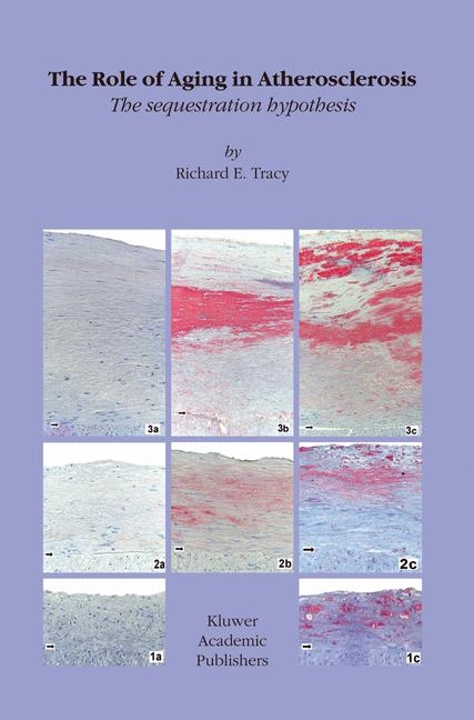 Role of Aging in Atherosclerosis -  R.E. Tracy