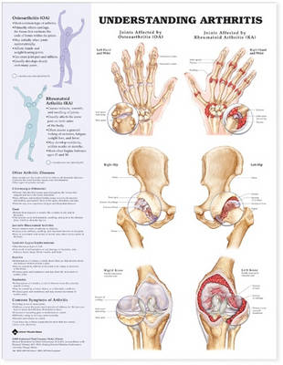 Rheumatology 3-Chart Set -  Lippincott Williams &  Wilkins